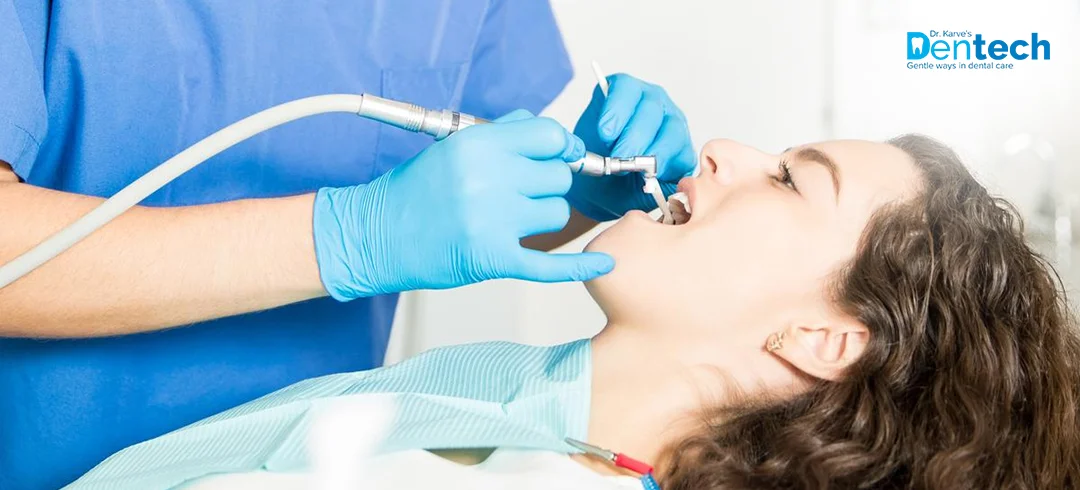 Root Canal Treatment in Powai at Dr. Karve's Dentech